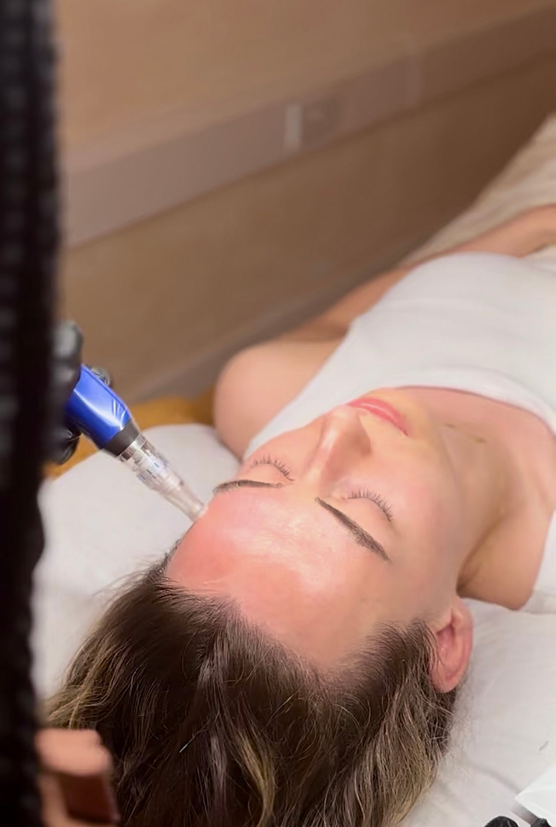 SkinPen 3 Sessions - Face 4 AVAILABLE